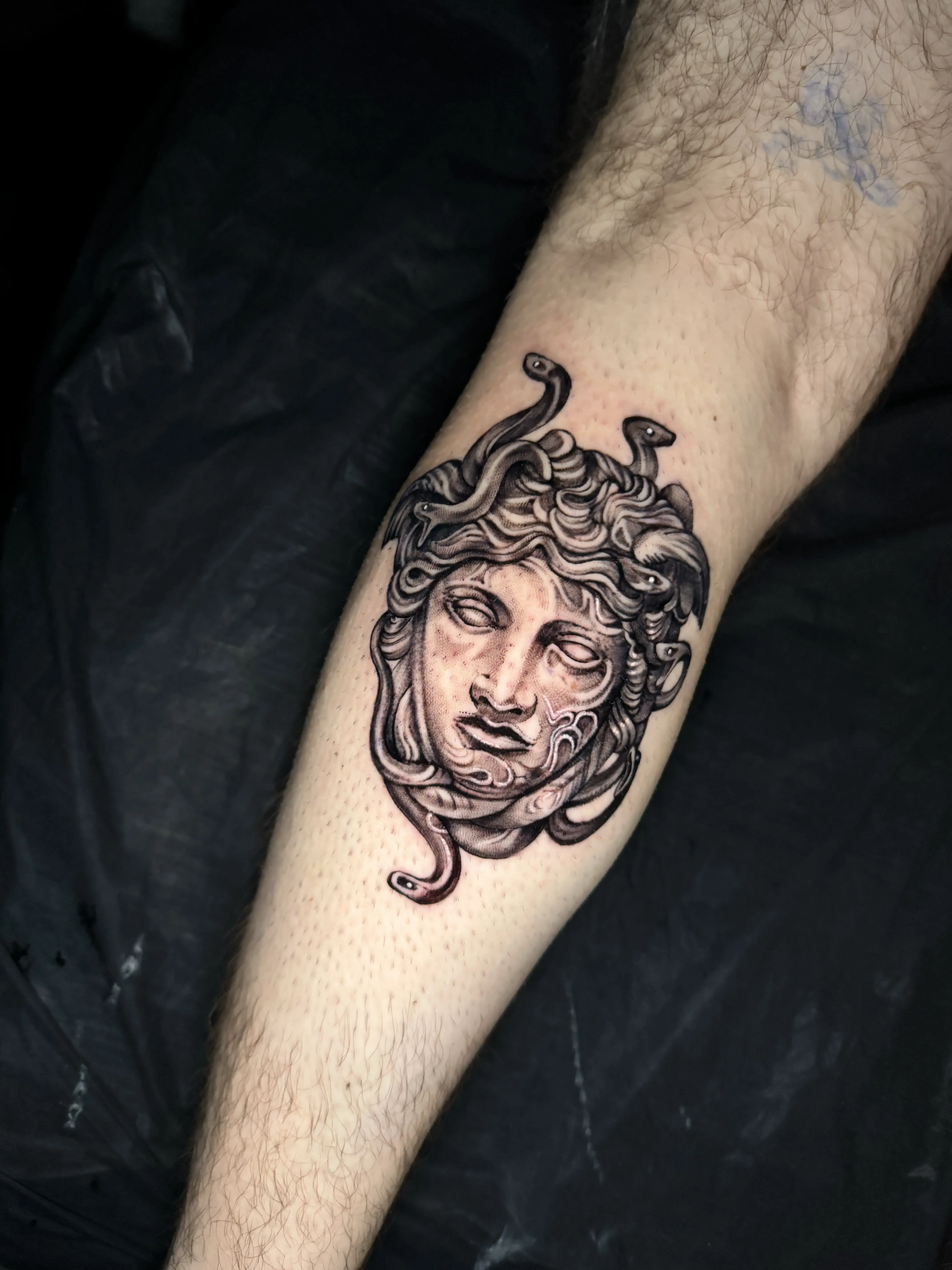 Medusa